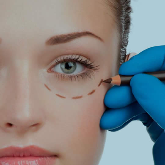 Dr. Juliano Souto Ferreira - Cirurgio Plstico - blefaroplastia